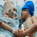 MEDICINA Y SALUD | Separaron con éxito a dos siameses que estaban unidos por el cerebro