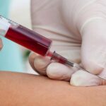 VIALE: Se confirman casos de dengue y COVID.