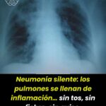 SALUD || NEUMONÍA SILENTE: CUANDO LOS PULMONES SE INFLAMAN… Y NADIE SE DA CUENTA